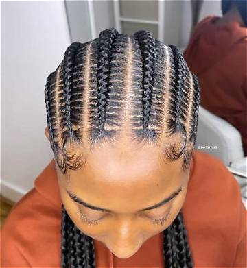 Are Feed-in Braids Actually Safe for Thin Hair? What Stylists Reveal