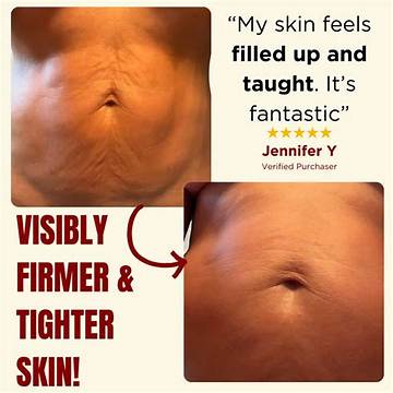 Besque Magic Body Oil Before and After: Real Results on Skin Texture and Glow