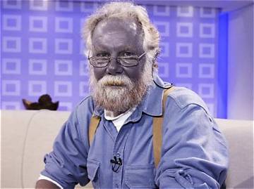 Real Humans Who Turned Blue: the Shocking True Medical Cases Behind the Line