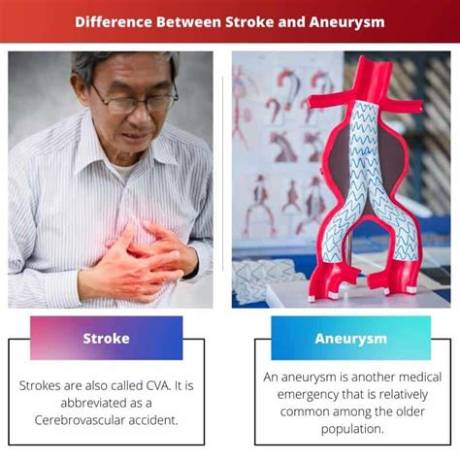 Stroke vs Aneurysm on Scans: How Doctors Spot the Difference Under Pressure
