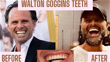 The Brutal Truth Behind Walton Goggins' Teeth: How He Lost Them Twice