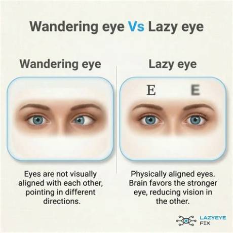 Why the 'Wandering Eye' Discourse Is Exploding Across Social Media Right Now