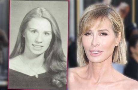 Young Carole Radziwill in Photos: Rare 90S Images from Abc News to Camelot Royalty
